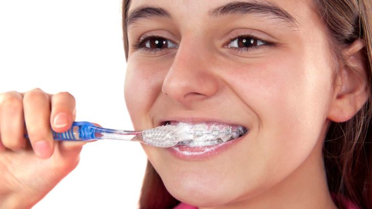 , Oral Hygiene + Care For Braces, Orthodontist Toronto Beach | Braces Toronto Beach | Invisalign Toronto Beach