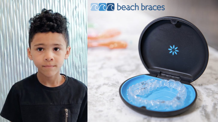 , Why Invisalign Is Suitable for Teen Patients at Beach Braces!, Orthodontist Toronto Beach | Braces Toronto Beach | Invisalign Toronto Beach
