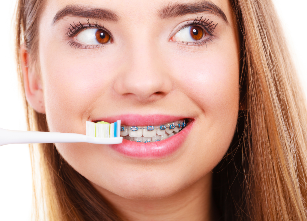 Tips For Taking Care Of Your Braces Orthodontist Toronto Beach